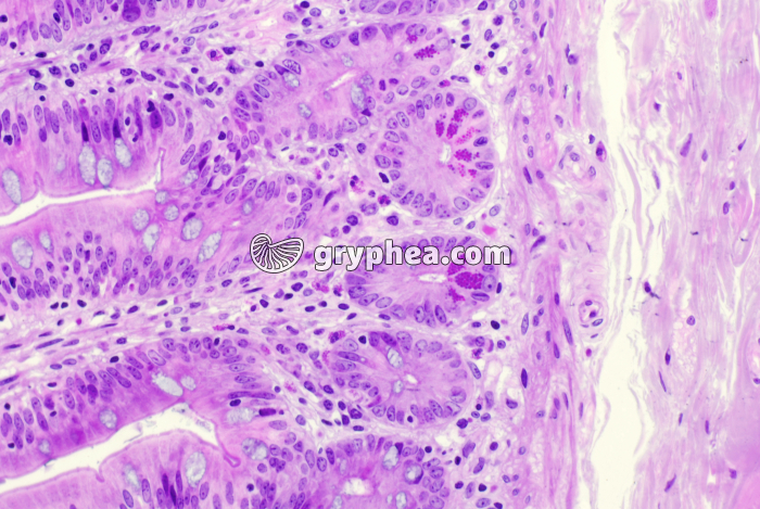 Intestin grêle - base des villosités avec cellules de Paneth x100 - gryphea.org